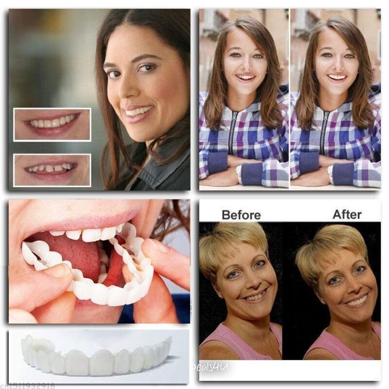Easy Fit Snap In Dentures