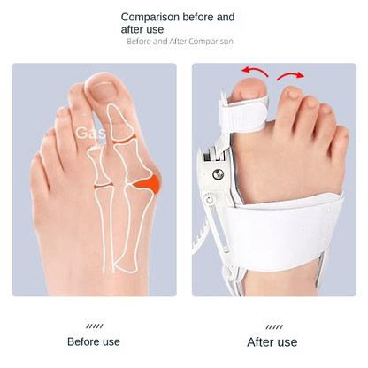 Comfortable Arch Support Insoles for Happy Feet