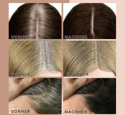 Easy Hairline Headband