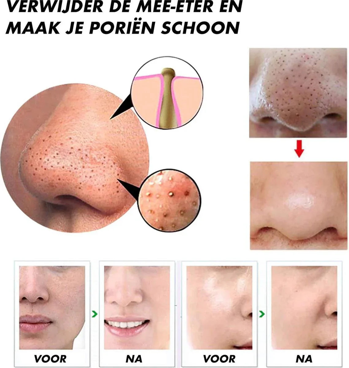 Pore Cleanser Electric Blackhead Extractor