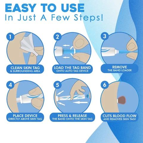 Easy Skin Tag Remover for Men and Women