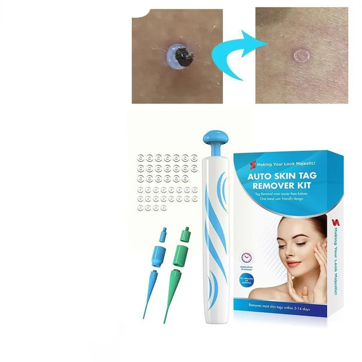 Easy Skin Tag Remover for Men and Women