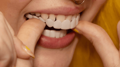 Easy Smile Makeover with Clip On Teeth Veneers
