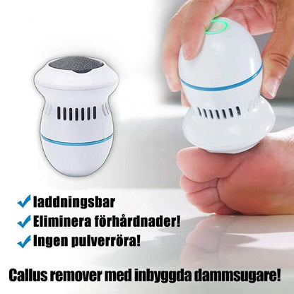 Foot File Callus Smoother Tool