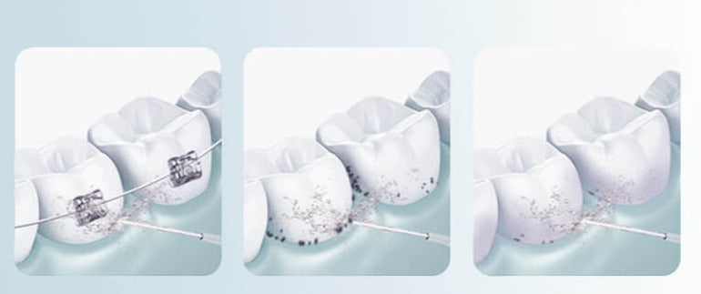 Compact Rechargeable Oral Water Flosser