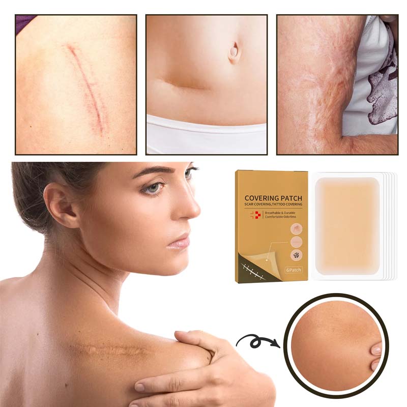 Clear Skin Concealer Sticker Patch