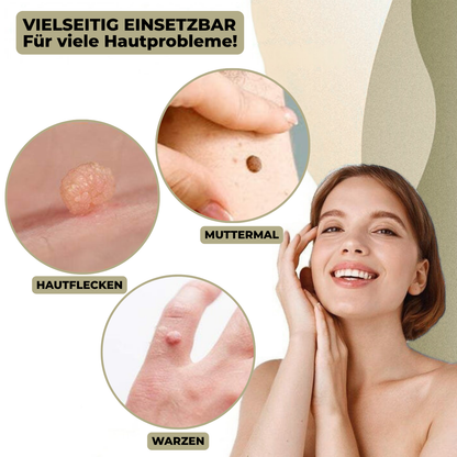 Easy Wart and Mole Remover for Home Use