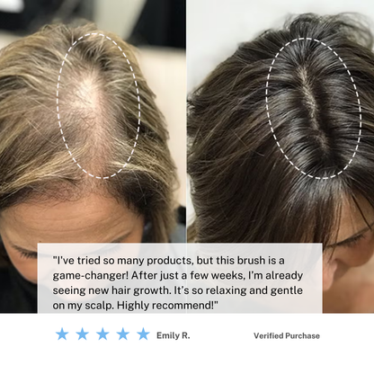 Rechargeable Scalp Massager Brush for Hair Growth