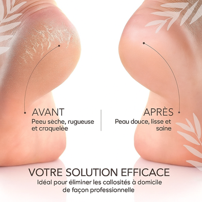Gentle Exfoliating Foot Care Cream