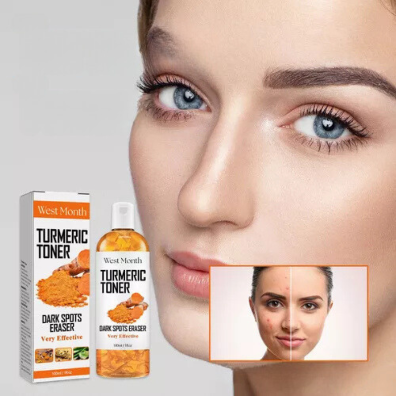 Radiant Skin Toner - Dark Spot Remover & Facial Brightener