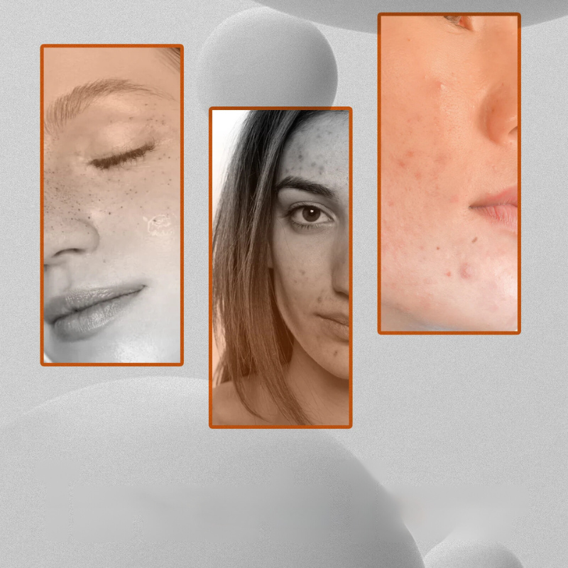 Radiant Skin Toner - Dark Spot Remover & Facial Brightener