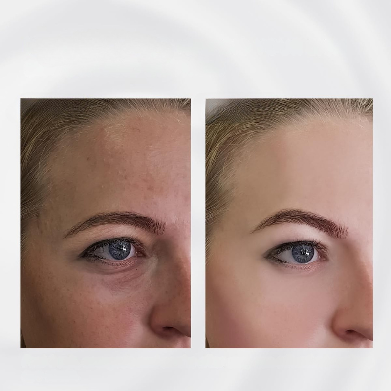Glowing Skin Firming Roller