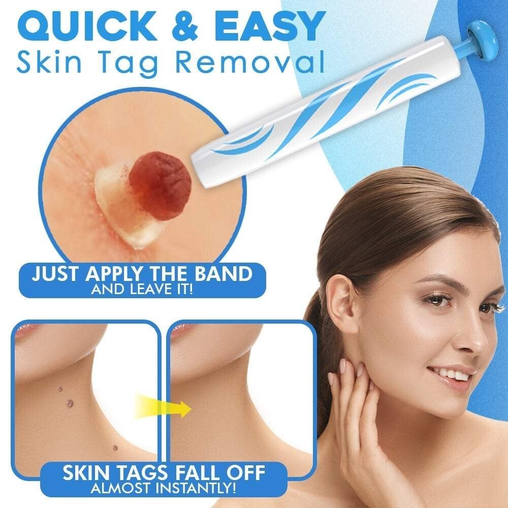 Easy Hair Removal Device for Smooth Skin - Fesara