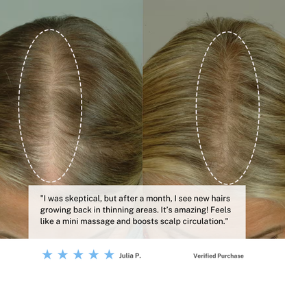 Rechargeable Scalp Massager Brush for Hair Growth
