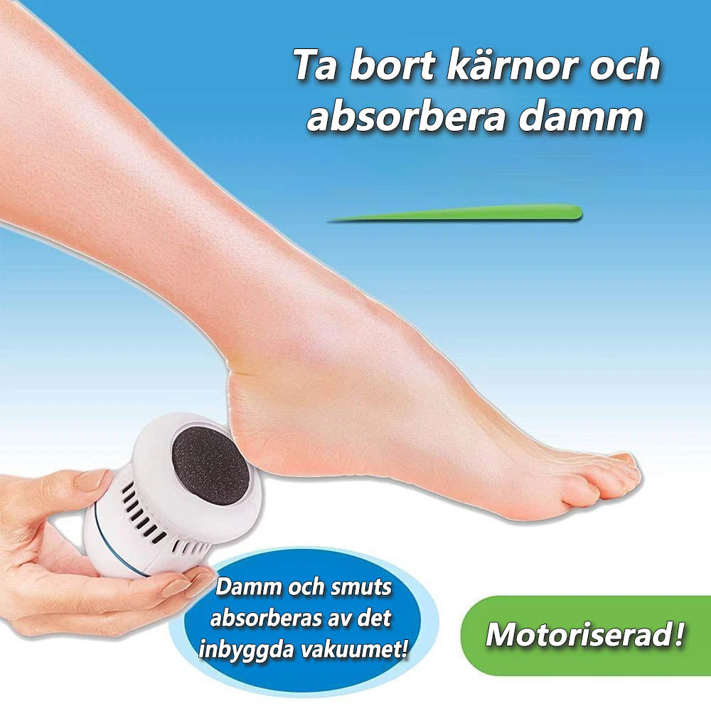 Foot File Callus Smoother Tool