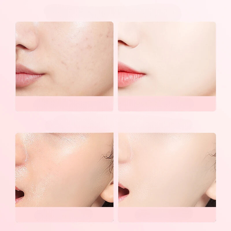 Natural Rose Facial Toner for Healthy Glowing Skin