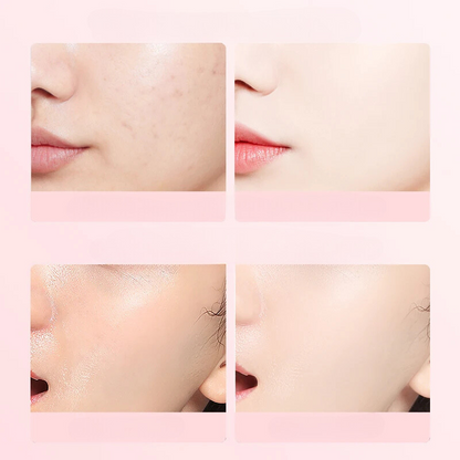 Natural Rose Facial Toner for Healthy Glowing Skin