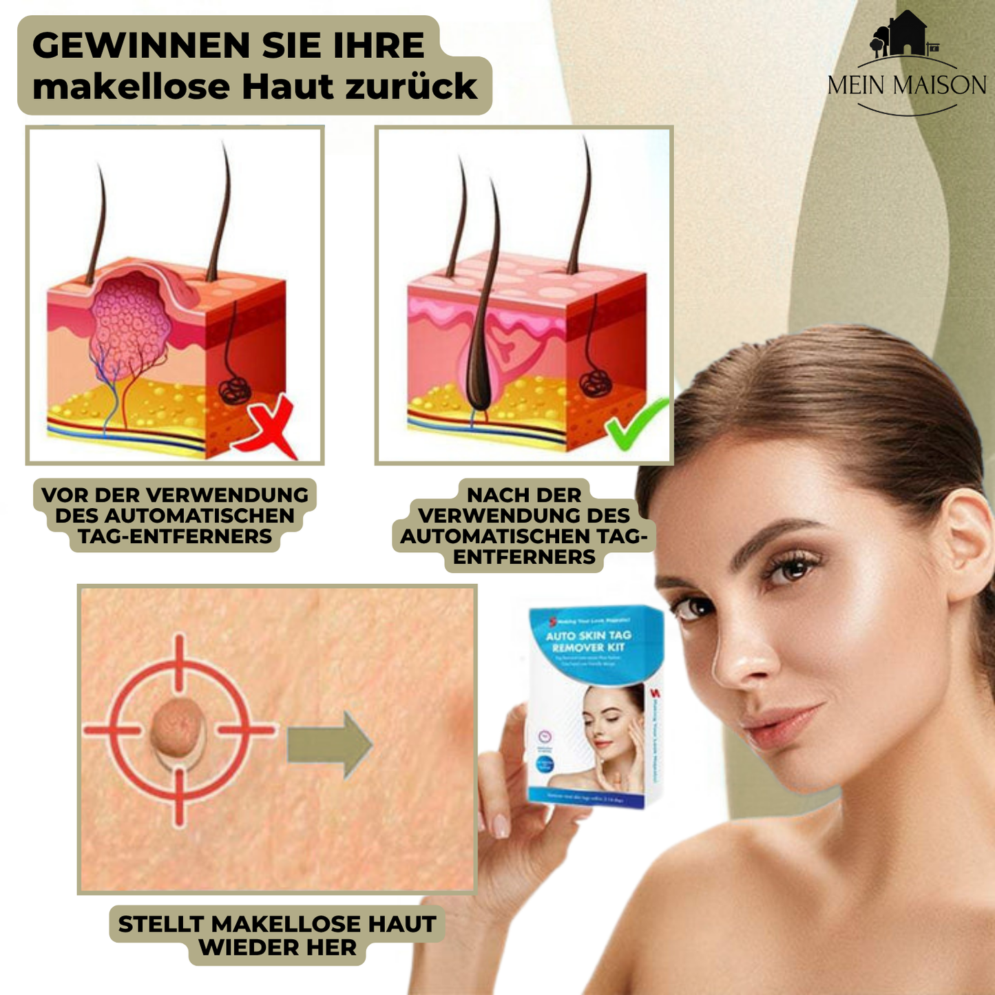 Easy Wart and Mole Remover for Home Use