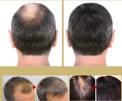 Nourishing Thickening Hair Supplement