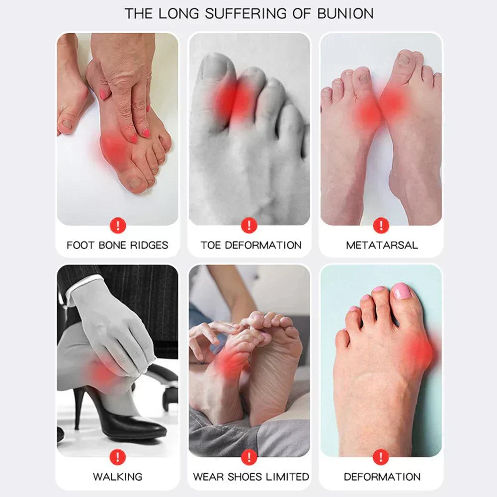 Orthopedic Shoe Insoles for Bunion Pain Relief