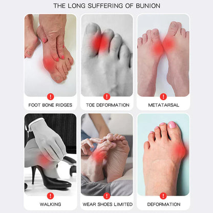 Orthopedic Shoe Insoles for Bunion Pain Relief