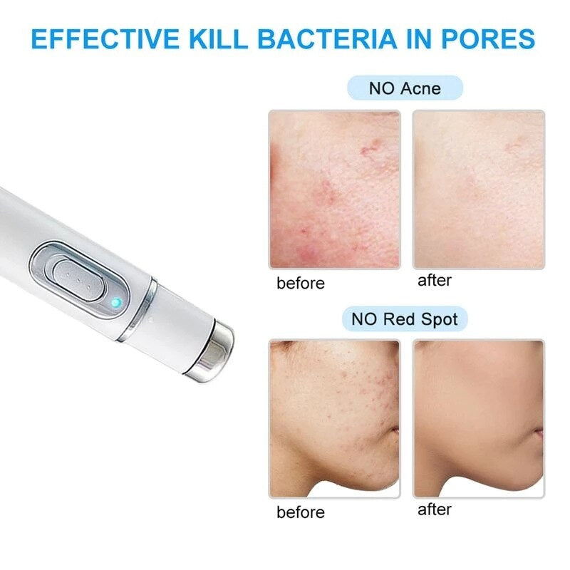 Advanced Anti Aging Skin Firming Device