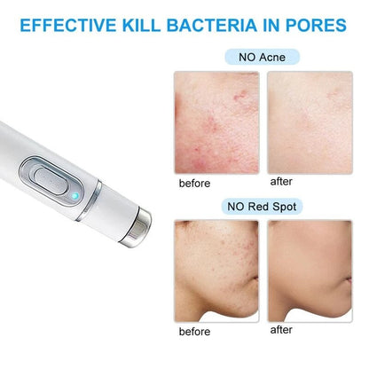 Advanced Anti Aging Skin Firming Device