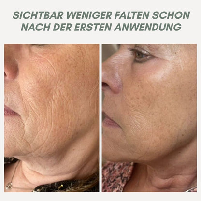 Instant Face Lift Cream for Younger Looking Skin
