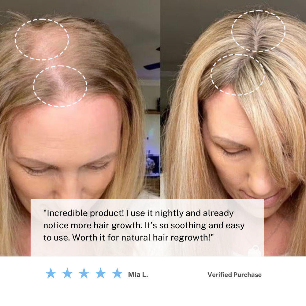 Rechargeable Scalp Massager Brush for Hair Growth