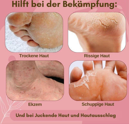Fast Relief Foot Cream for Dry Itchy Feet