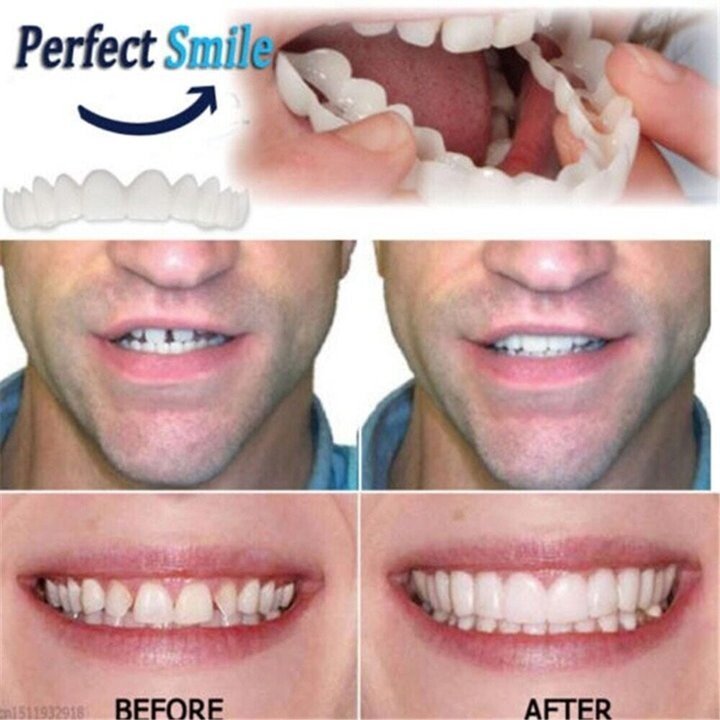 Easy Fit Snap In Dentures
