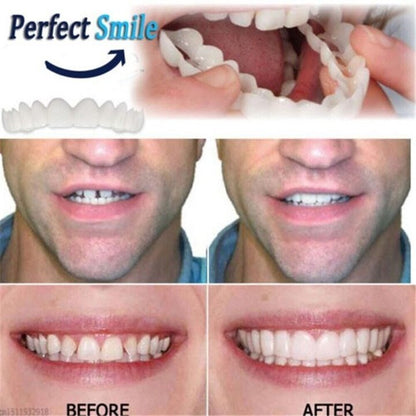 Easy Fit Snap In Dentures