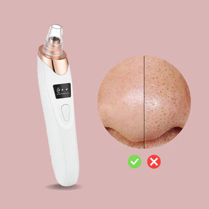 Easy Pore Cleaner Blackhead Remover Device