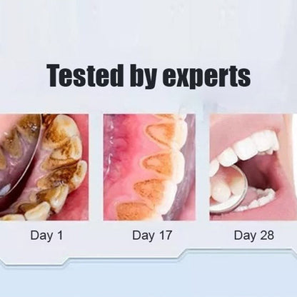 Natural Whitening Probiotic Toothpaste