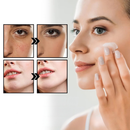 SootheAid Redness Relief Cream