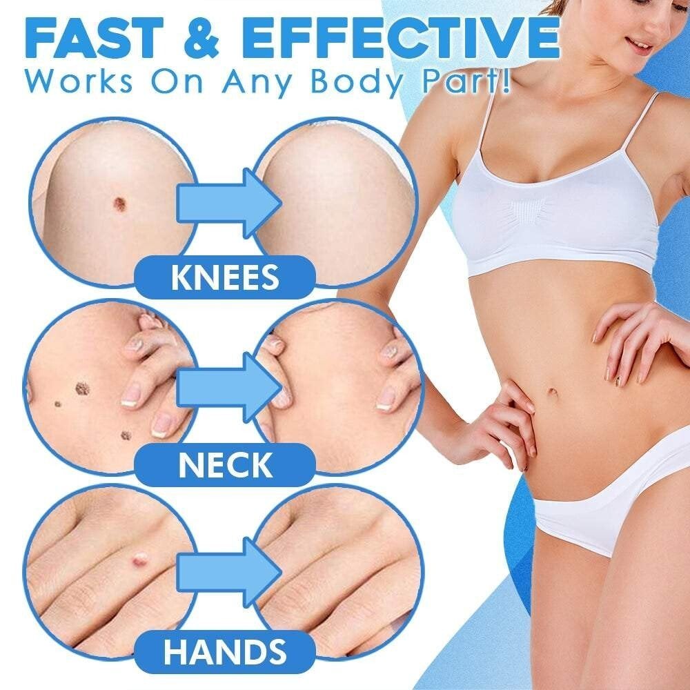 Easy Hair Removal Device for Smooth Skin