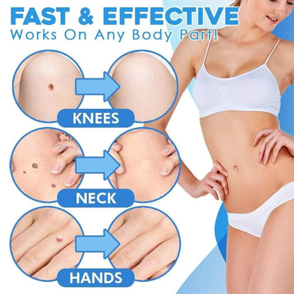 Easy Hair Removal Device for Smooth Skin