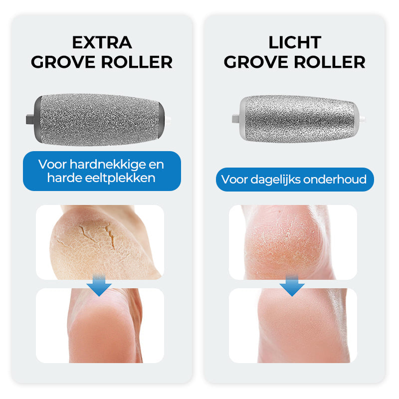 Soft Touch Foot Smoother
