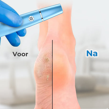 Soft Touch Foot Smoother