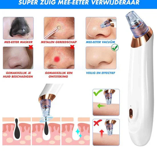 Pore Cleanser Electric Blackhead Extractor