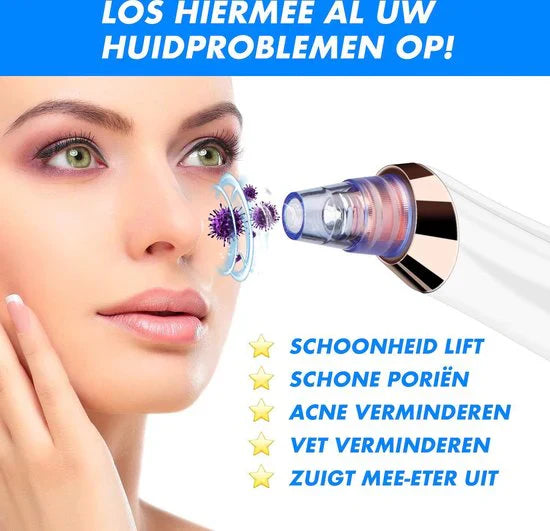 Pore Cleanser Electric Blackhead Extractor