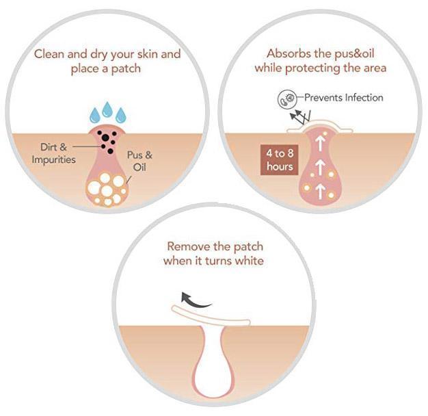 Fast Healing Pimple and Spot Patch