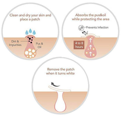 Fast Healing Pimple and Spot Patch
