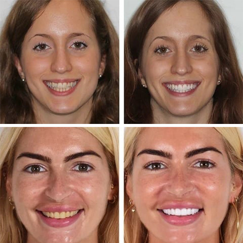Natural Whitening Probiotic Toothpaste