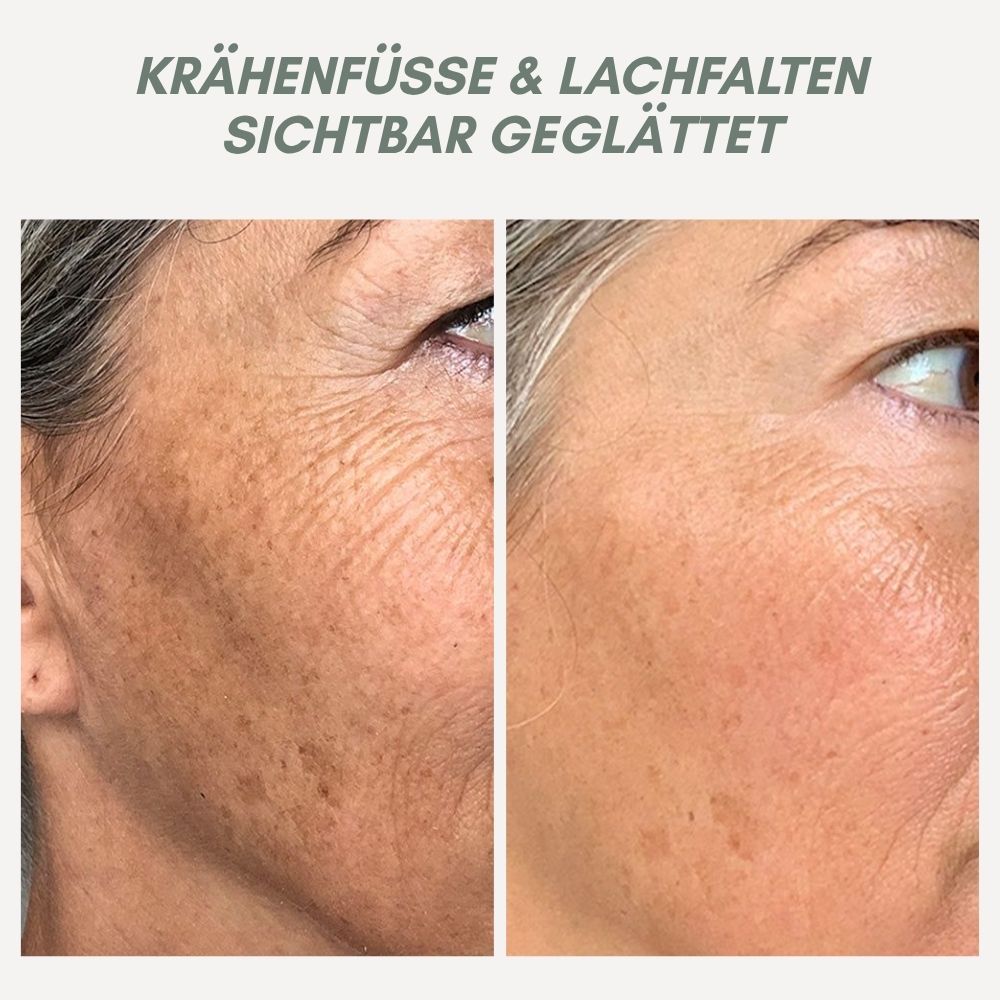 Instant Face Lift Cream for Younger Looking Skin
