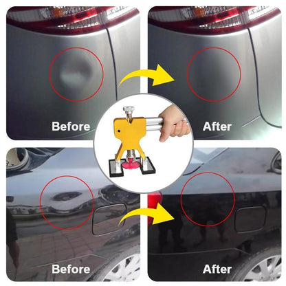 Auto Body Dent Removal Kit