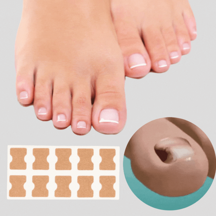 Natural Nail Repair Patches for Healthy Nails - Fesara