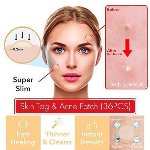 Fast Healing Pimple and Spot Patch