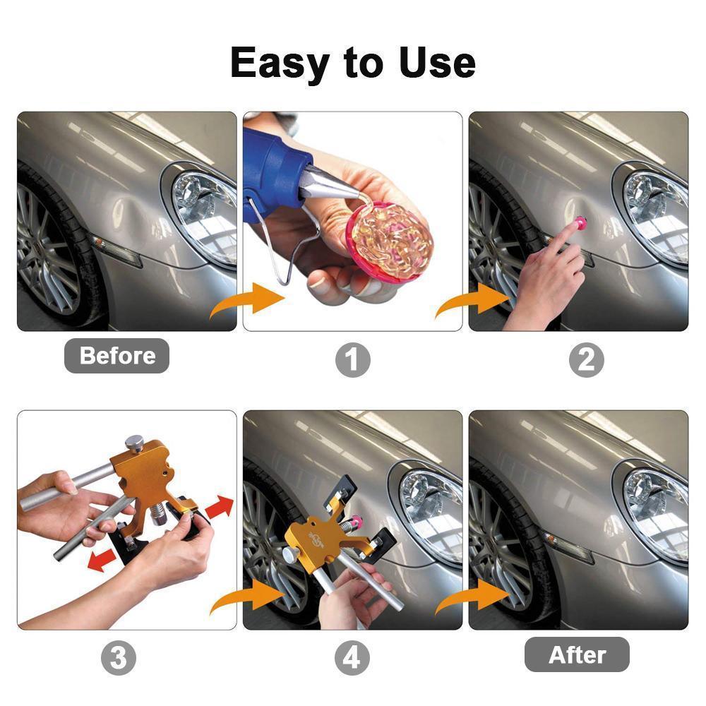 Auto Body Dent Removal Kit