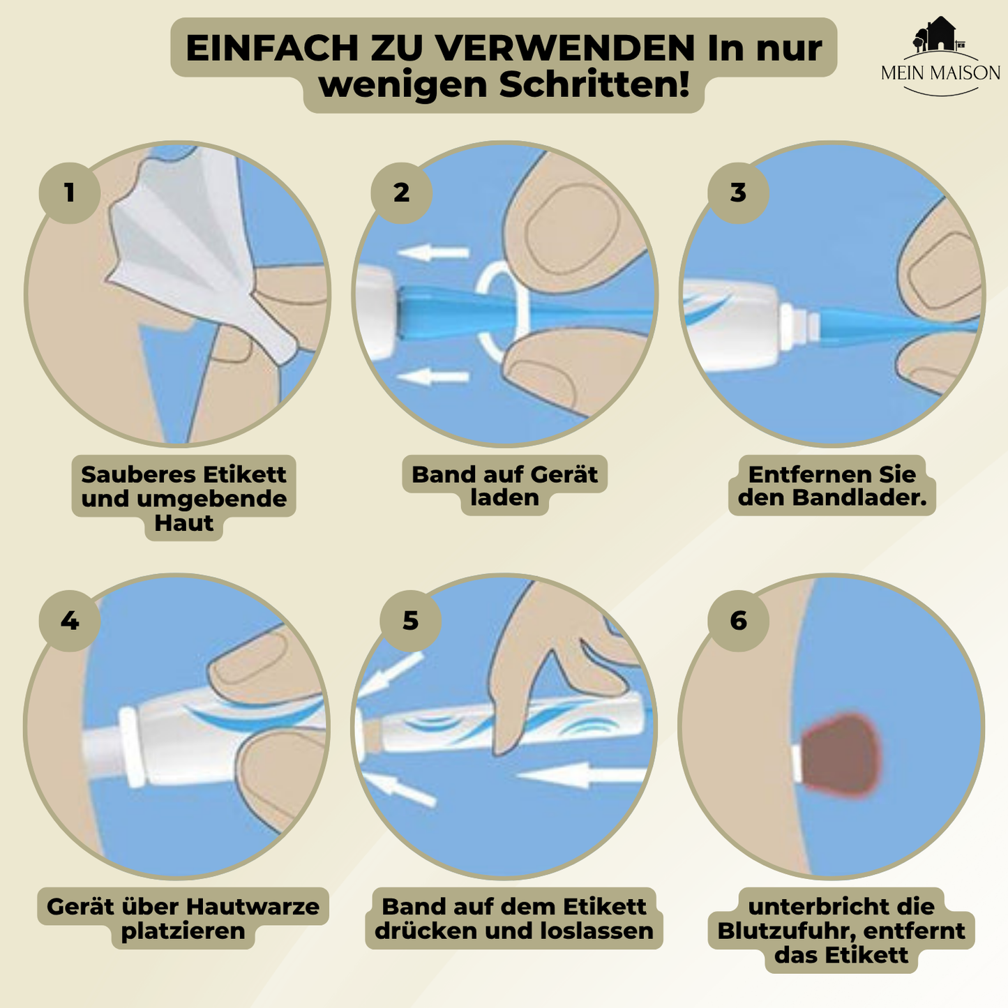 Easy Wart and Mole Remover for Home Use